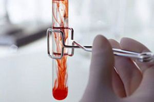 Семяизвержение с кровью, почему появляется примесь в сперме